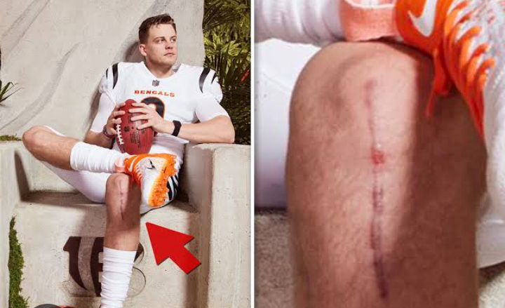 BREAKING NEWS:     JOE BURROW OPENS UP ABOUT MENTAL HEALTH STRUGGLE AS AGAINST SO MANY SUSTAINED INJURIES AND…